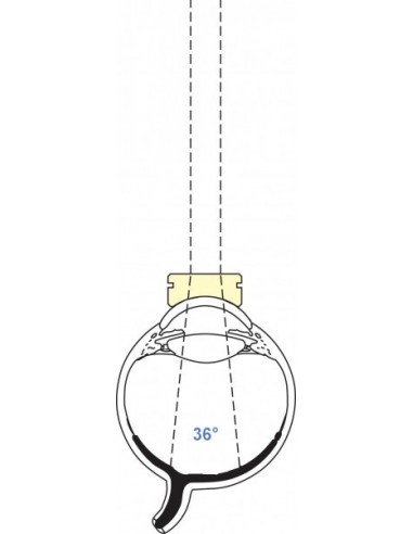OCULAR PEDIATRIC OPV-F