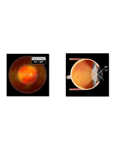 LOUPE VOLK 90D