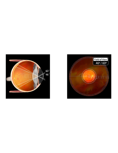 LOUPE VOLK 20D