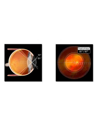 LOUPE VOLK 78D CLAIRE