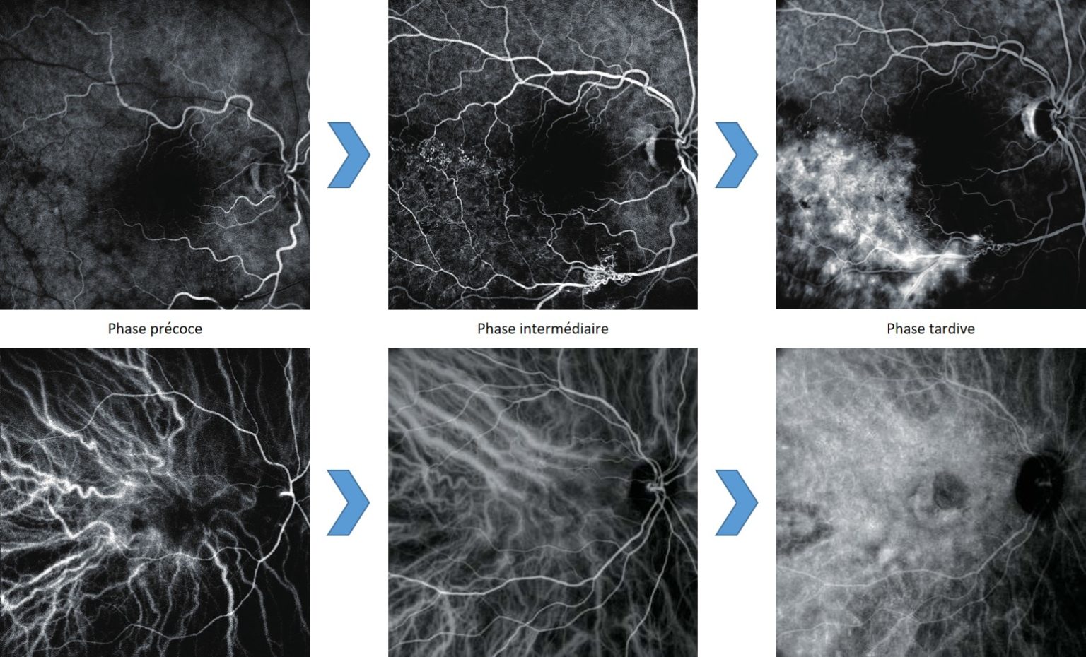 Angiographie : imagerie vasculaire de la rétine - NIDEK France