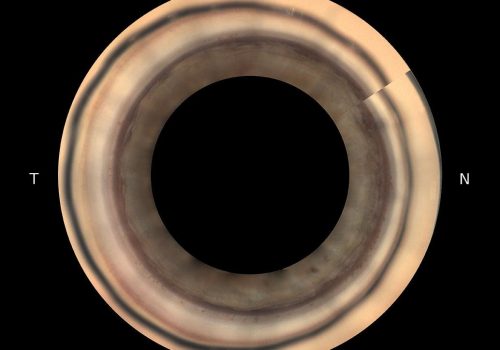 GS-Stitching-Circular_MK