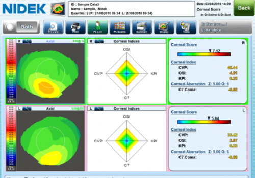 Image11 corneal score