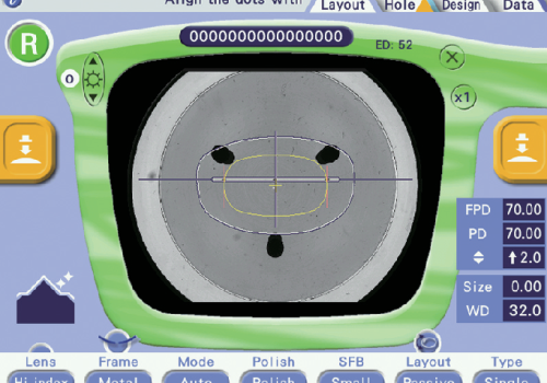 P3_Clear_lens_imaging_1_lens_up