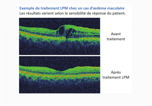 PageProduit_MC500_Description_Visuel10_ExempleLPM_V2 site web