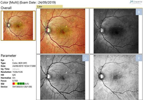 Analyse en photocouleur et décomposition R/G/B