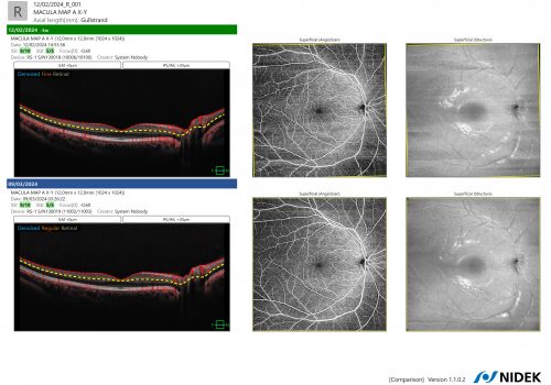 PageProduit_RS1_Description_Visuel4_OCTAFU