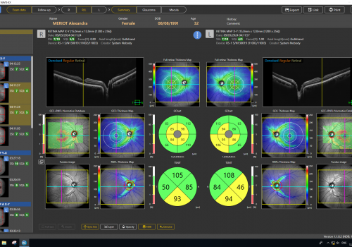 PageProduit_RS1_Description_Visuel6_RetinaMap