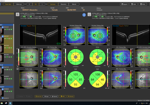 PageProduit_RS1_Description_Visuel6_RetinaMap