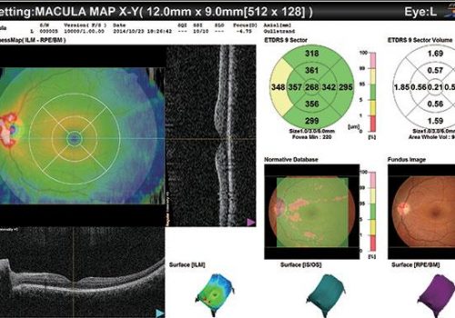 PageProduit_RS330_Description_Visuel12_MMapOeilUnique