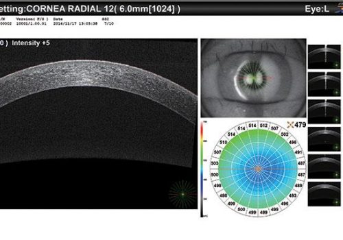 PageProduit_RS330_Description_Visuel6_Pachy