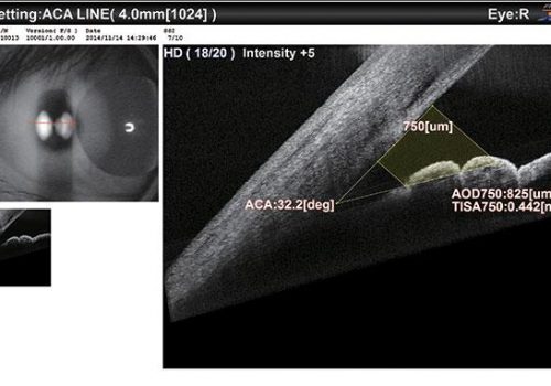 PageProduit_RS330_Description_Visuel7_ACA