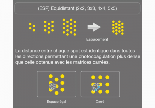 PageProduit_YLC500_Description_Visuel5_ESP_V2 site web