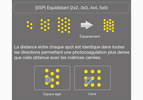 PageProduit_YLC500_Description_Visuel5_ESP_V2 site web