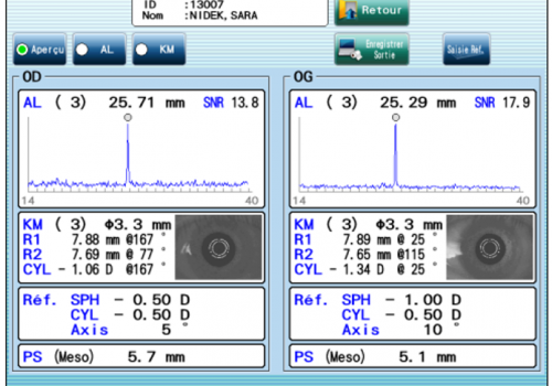 al-scan m screen