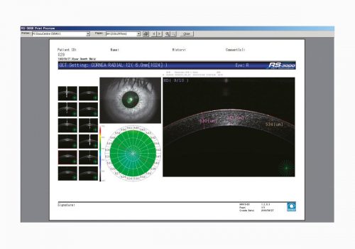 Cartographie d’épaisseur de la cornée